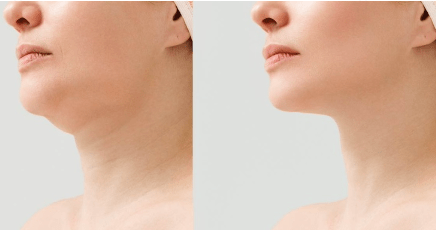 Clinic network ‘Aesthetic cosmetology Batumi’