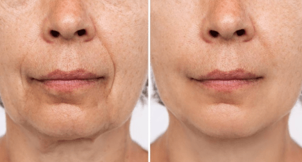 Clinic network ‘Aesthetic cosmetology Batumi’