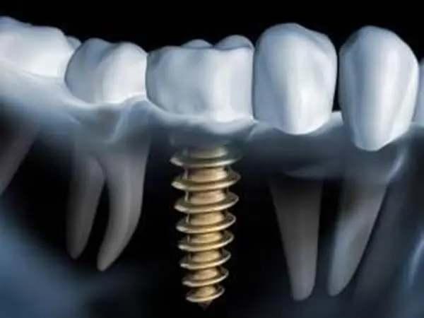 Dentist-Ge Dental Clinic – Caring for Your Smile Since 2007